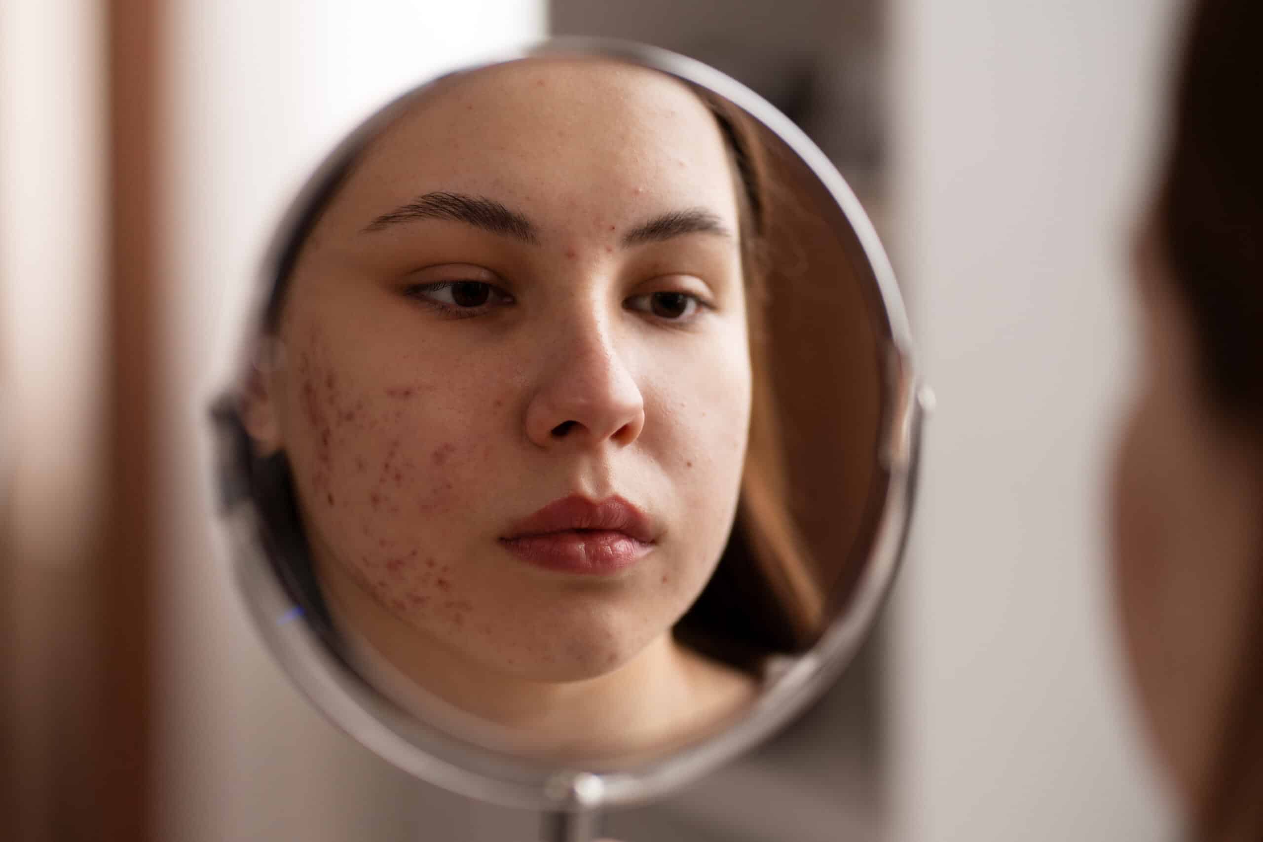 FAQs About Scarring