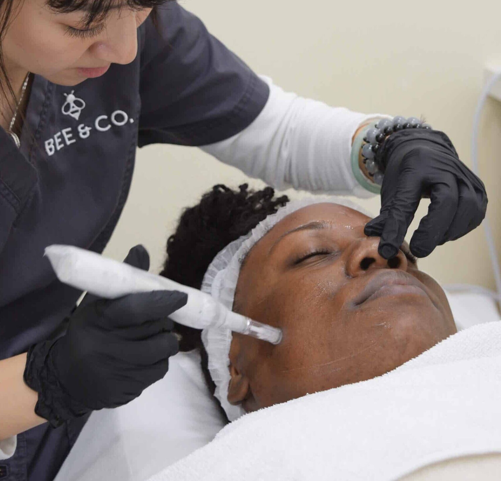 MICRONEEDLING