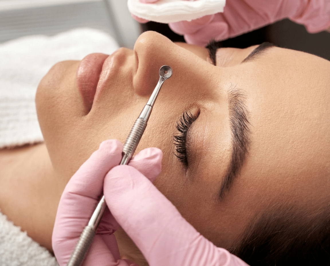 Why Clients Choose Extractions