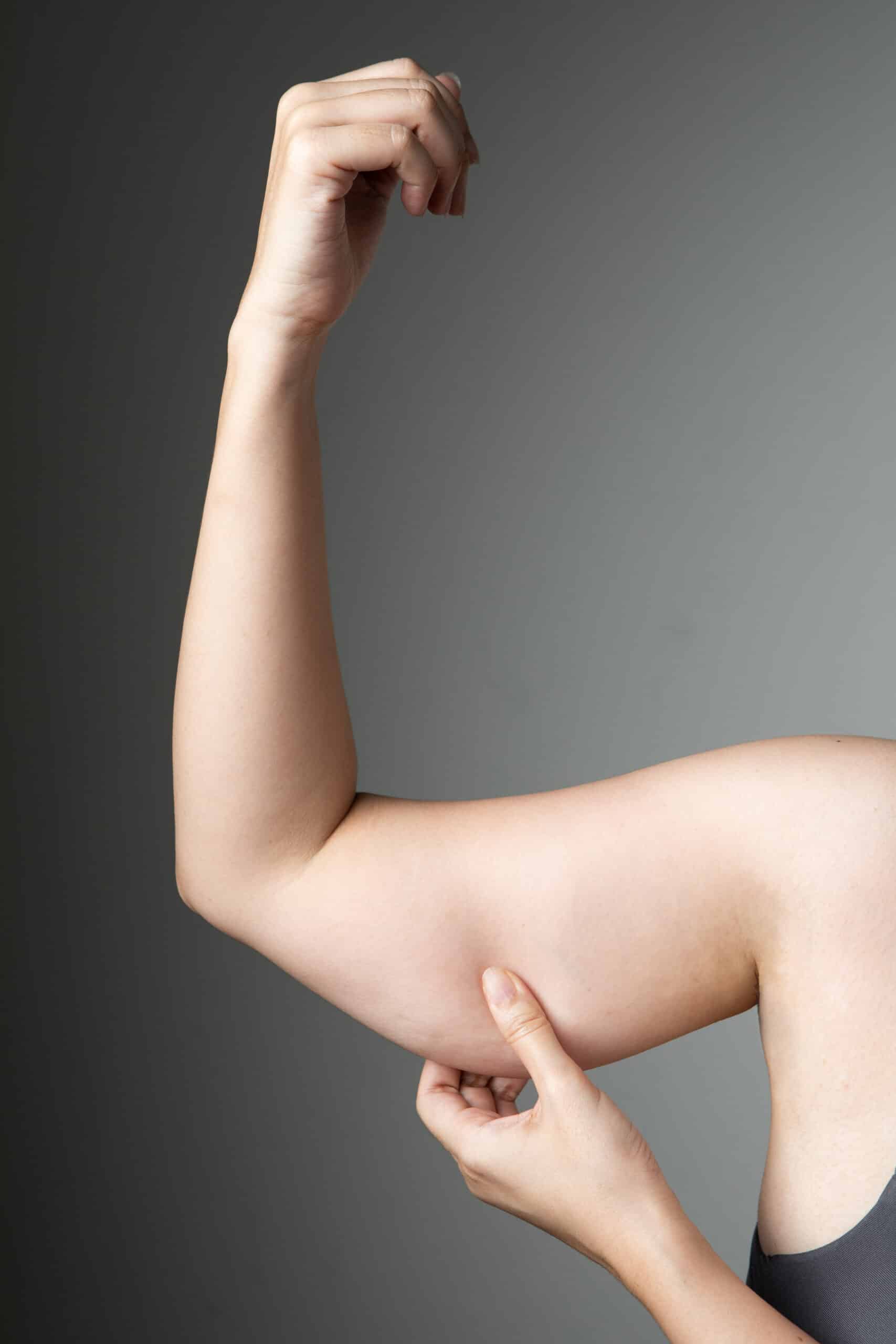 FAQs About Stubborn Fat