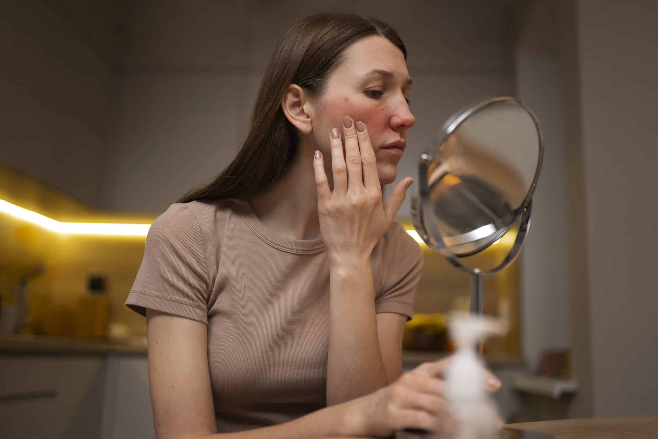 FAQs About Rosacea & Redness