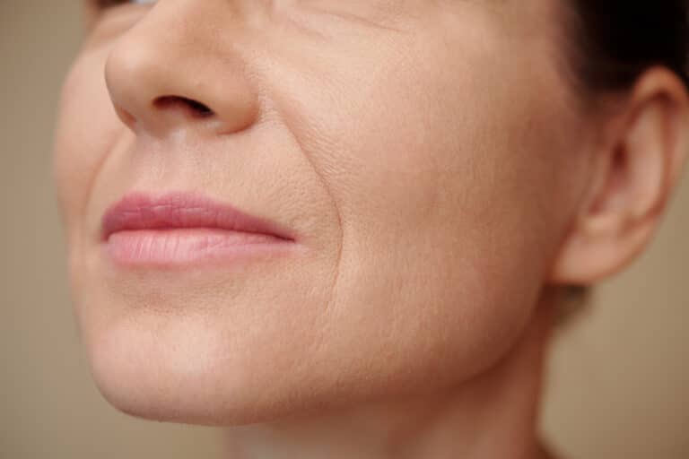 WRINKLES & FINE LINES