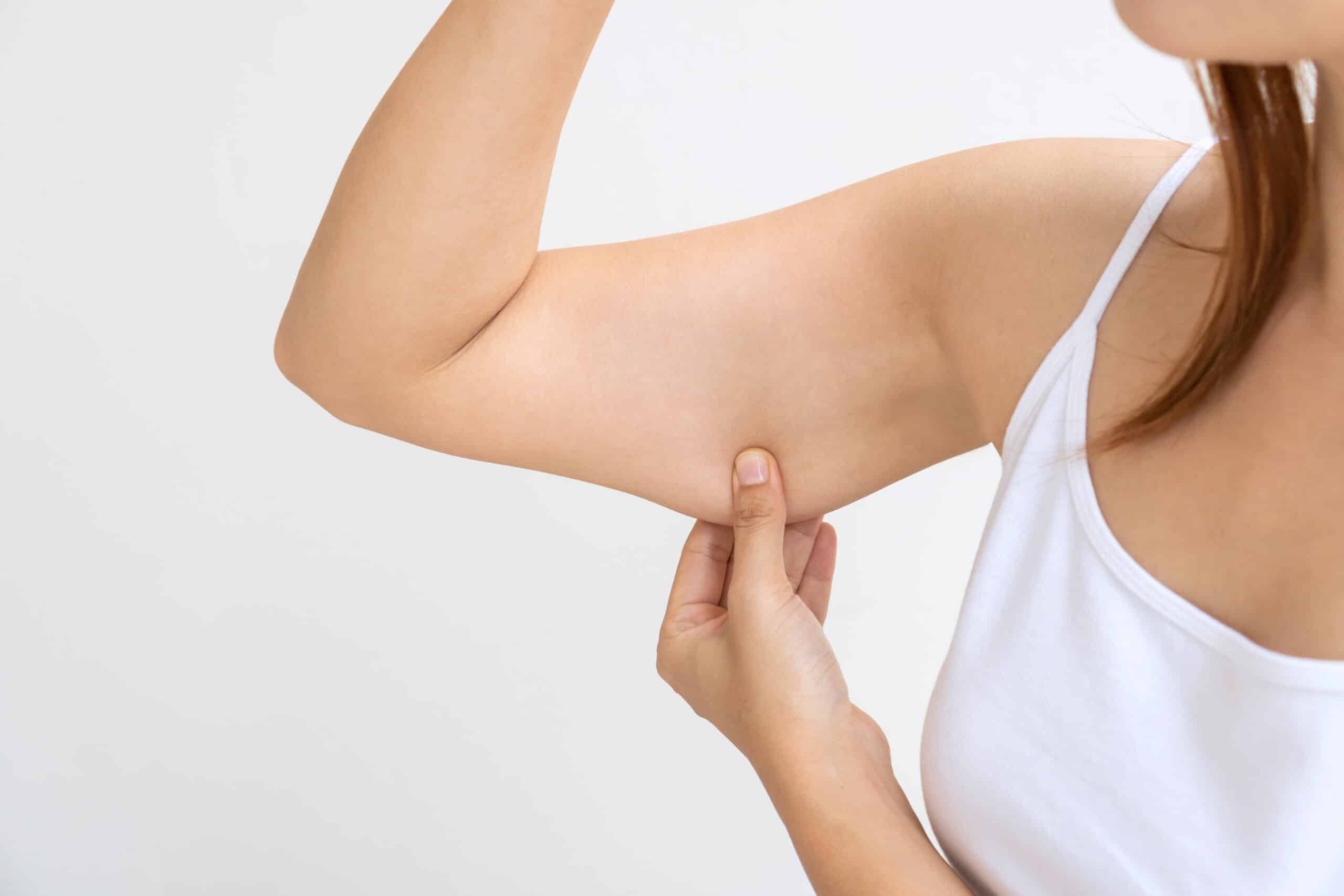 What Causes Loose Skin After Weight Loss?